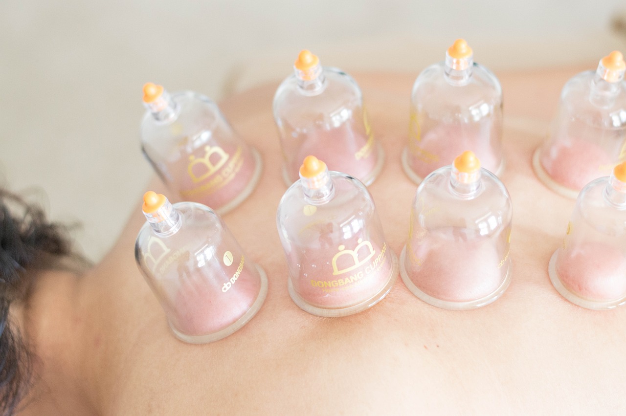 Schröpfen Paravertebral